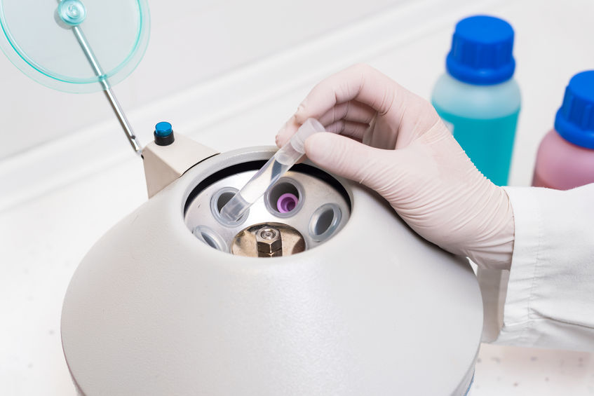 Anwendungsbeispiel Laborautomation: Zentrifuge